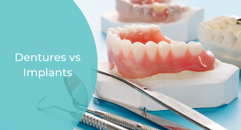 Dentures vs Implants: A Comprehensive Guide to Your Dental Health