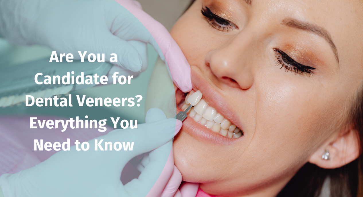 Are You a Candidate for Dental Veneers? Everything You Need to Know