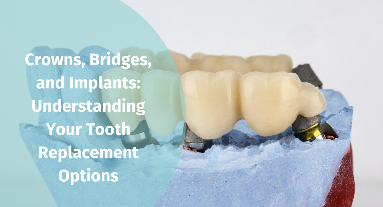 Crowns, Bridges, and Implants: Understanding Your Tooth Replacement Options